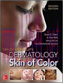 [PDF]Taylor and Kelly’s Dermatology for Skin of Color, 2nd Edition