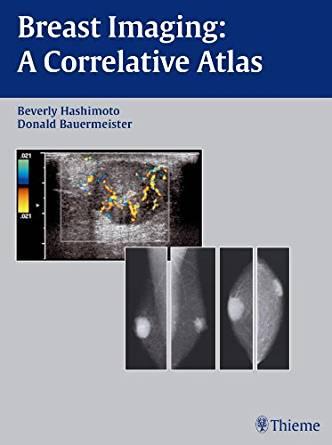 Breast Imaging - A Correlative Atlas