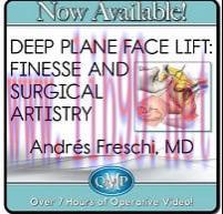[AME]Deep Plane Face Lift: Finesse and Surgical Artistry 2023 (Videos)
