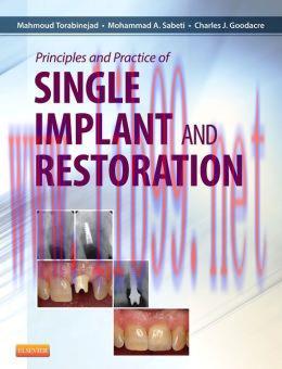 [AME]Principles and Practice of Single Implant and Restorations
