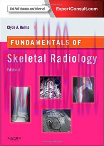 [PDF]Fundamentals of Skeletal Radiology, 4th Edition