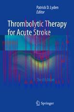 [PDF]Thrombolytic Therapy for Acute Stroke