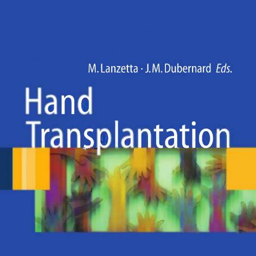 Hand Transplantation