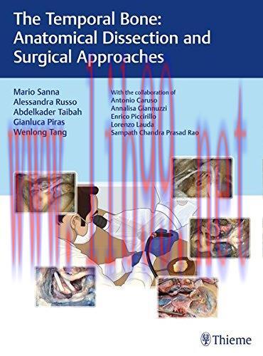 [AME]The Temporal Bone: Anatomical Dissection and Surgical Approaches (PDF)