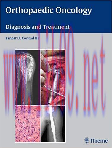 (PDF)Orthopaedic Oncology: Diagnosis and Treatment 1st Edition