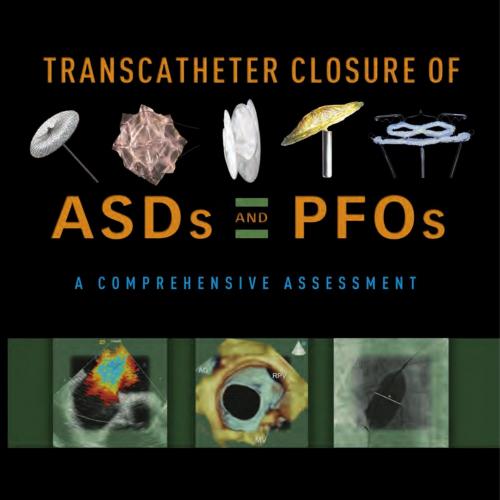 Transcatheter Closure of ASDs and PFOs A Comprehensive Assessment