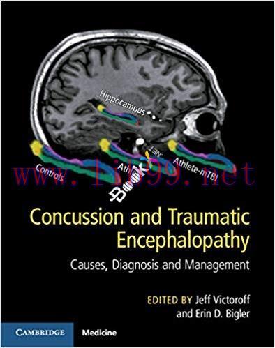 [PDF]Concussion and Traumatic Encephalopathy Causes, Diagnosis, and Management