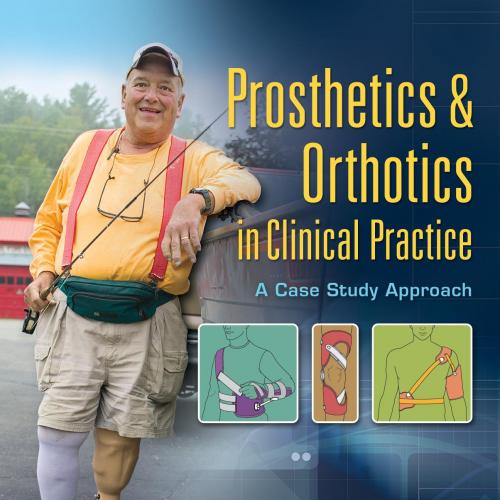 Prosthetics and Orthotics in Clinical PracticeA Case Study