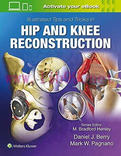 [AME]Illustrated Tips and Tricks in Hip and Knee Reconstructive and Replacement Surgery (EPUB)