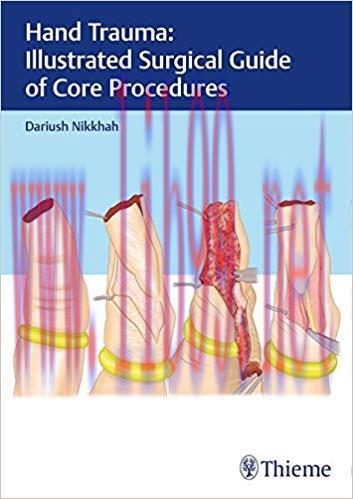 [PDF]Hand Trauma - Illustrated Surgical Guide of Core Procedures