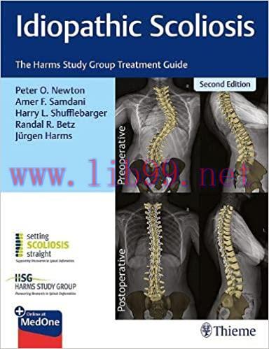 [PDF]Idiopathic Scoliosis The Harms Study Group Treatment Guide 2nd Edition PDF+EPUB