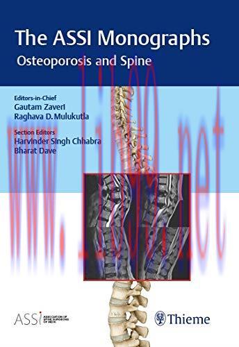 [AME]The ASSI Monographs &ndash; Osteoporosis and Spine (Original PDF)