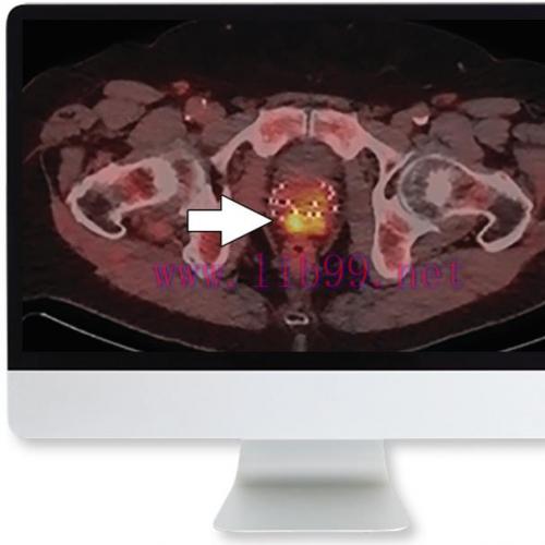 [AME]Molecular Imaging and Therapy of Prostate Cancer 2020 (CME VIDEOS)