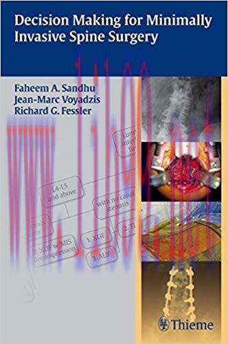 [PDF]Decision Making for Minimally Invasive Spine Surgery