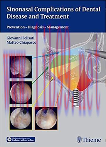 [PDF]Sinonasal Complications of Dental Disease and Treatment - Prevention Diagnosis Management ...