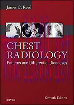 (PDF)Chest Radiology: Patterns and Differential Diagnoses E-Book 7th Edition