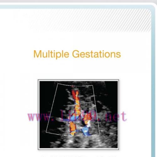 [AME]AIUM Multiple Gestations (CME VIDEOS)