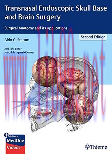 [AME]Transnasal Endoscopic Skull Base and Brain Surgery: Surgical Anatomy and its Applications ...