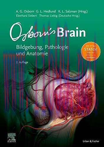 [AME]Osborn's brain: Bildgebung, Pathologie und Anatomie (German Edition) (True PDF)