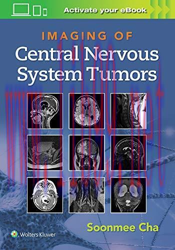 [AME]Imaging of Central Nervous System Tumors (ePub3+Converted PDF)