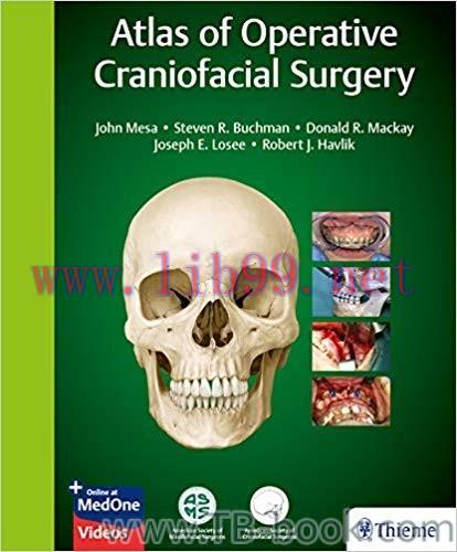Atlas of Operative Craniofacial Surgery 1st Edition by John Mesa
