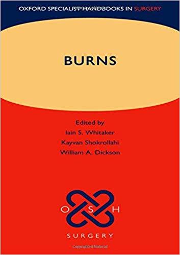 Burns (Oxford Specialist Handbooks in Surgery)