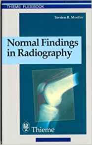 Normal Findings in Radiography
