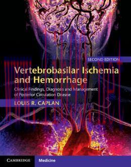 [AME]Vertebrobasilar Ischemia and Hemorrhage, 2nd Edition (ORIGINAL PDF from_ Publisher)