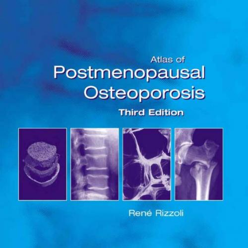 Atlas of Postmenopausal Osteoporosis, 3rd Edition
