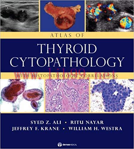 [PDF]Atlas of Thyroid Cytopathology With Histopathologic Correlations