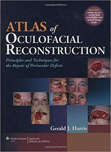 Atlas of Oculofacial Reconstruction Principles and Techniques for the Repair of Periocular Defe...