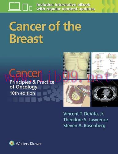 [AME]Cancer: Principles & Practice of Oncology: Cancer of the Breast (EPUB)
