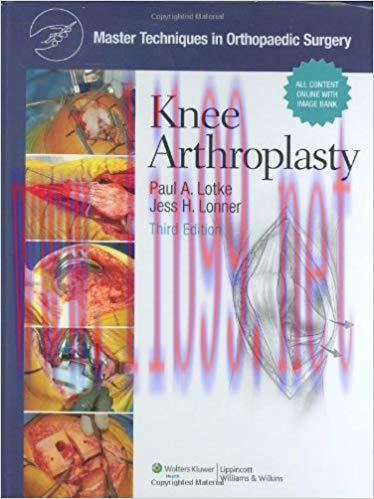 [PDF]Master Techniques in Orthopaedic Surgery - Knee Arthroplasty, 3rd Edition+CHM版