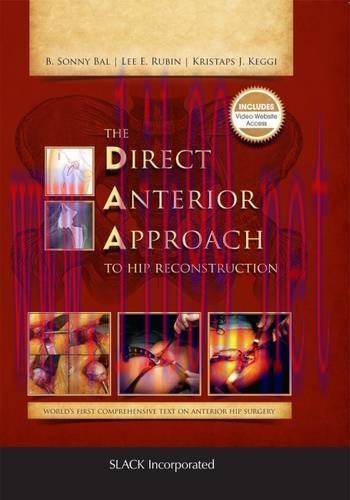 [AME]The Direct Anterior Approach to Hip Reconstruction (PDF)