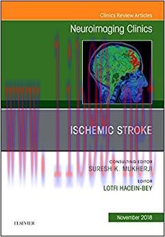 [AME]Ischemic Stroke, An Issue of Neuroimaging Clinics of North America (Volume 28-4) (The Clin...
