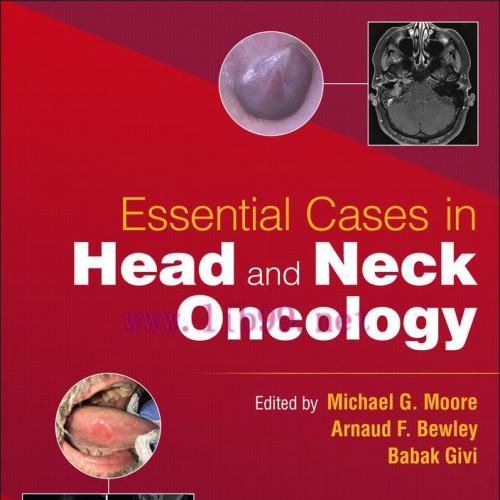 [AME]Essential Cases in Head and Neck Oncology (EPUB)