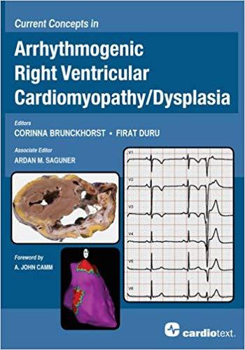 Current Concepts in Arrhythmogenic Right Ventricular Cardiomyopathy-Dysplasia