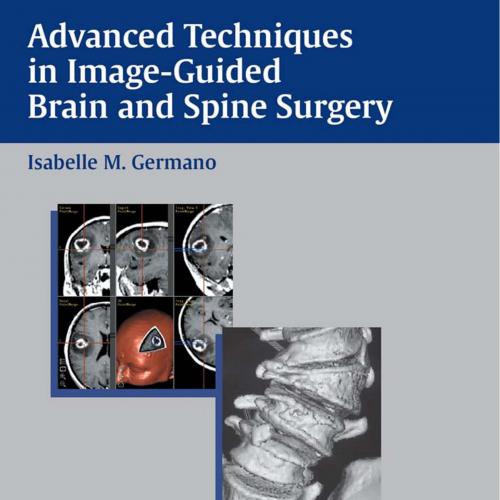 Advanced Techniques in Image-Guided Brain and Spine Surgery - Wei Zhi