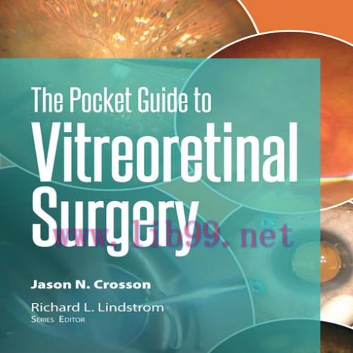 [AME]Pocket Guide to Vitreoretinal Surgery (EPUB)