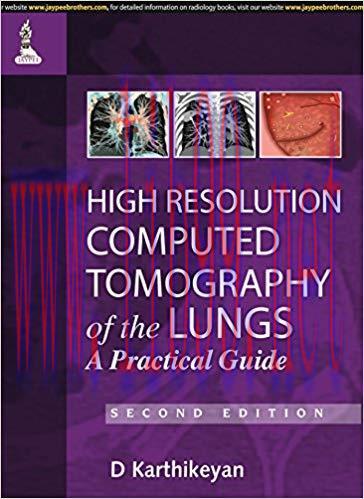 [PDF]High Resolution Computed Tomography of the Lungs, 2nd Edition