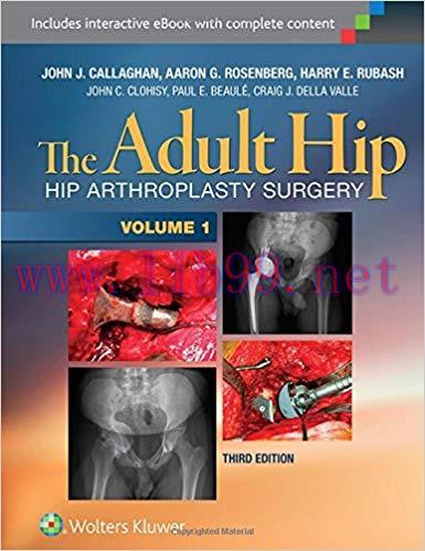 [CHM]The Adult Hip - Hip Arthroplasty Surger , 3rd Edition 2 Volume Set
