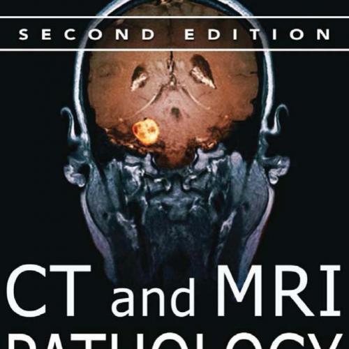CT and MRI Pathology A Pocket Atlas, 2nd Edition