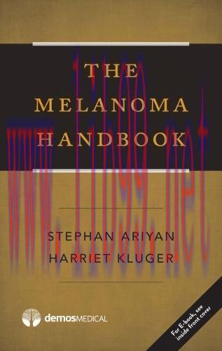 [AME]The Melanoma Handbook (EPUB)