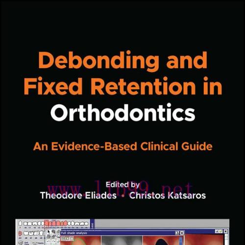 [AME]Debonding and Fixed Retention in Orthodontics (EPUB)