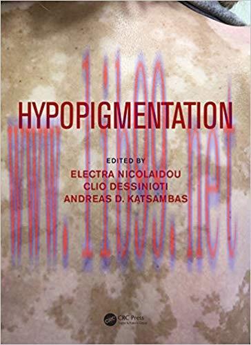 [PDF]Hypopigmentation