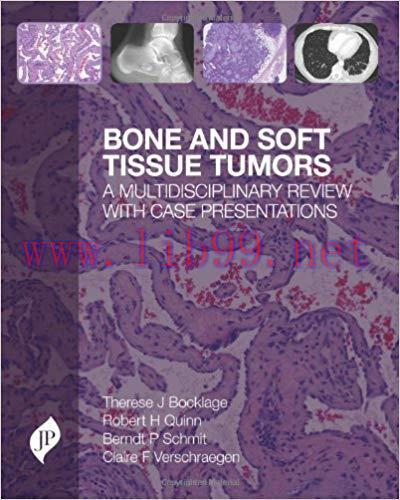 [PDF]Bone and Soft Tissue Tumors