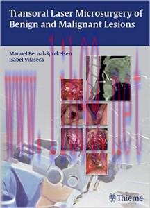 [AME]Transoral Laser Microsurgery of Benign and Malignant Lesions (EPUB)