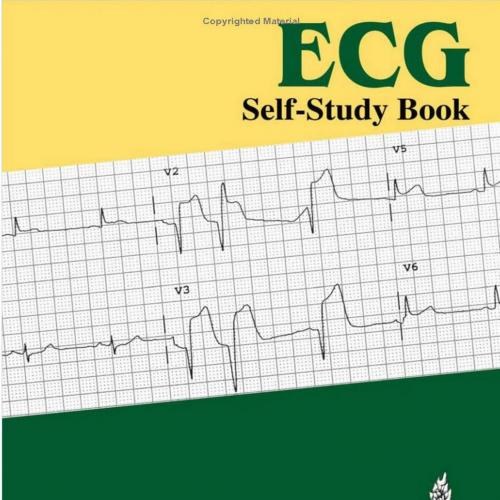 ECG Self-Study Book - Wei Zhi