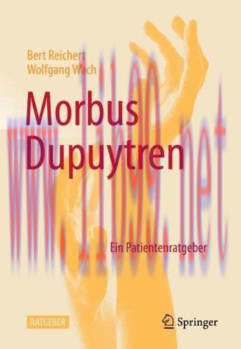 [AME]Morbus Dupuytren: Ein Patientenratgeber (German Edition) (Original PDF)