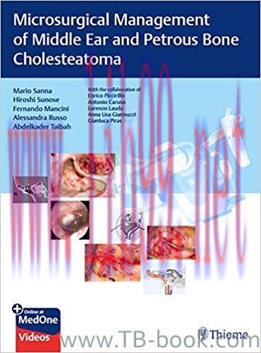 Microsurgical Management of Middle Ear and Petrous Bone Cholesteatoma 1st Edition by Mario Sann...
